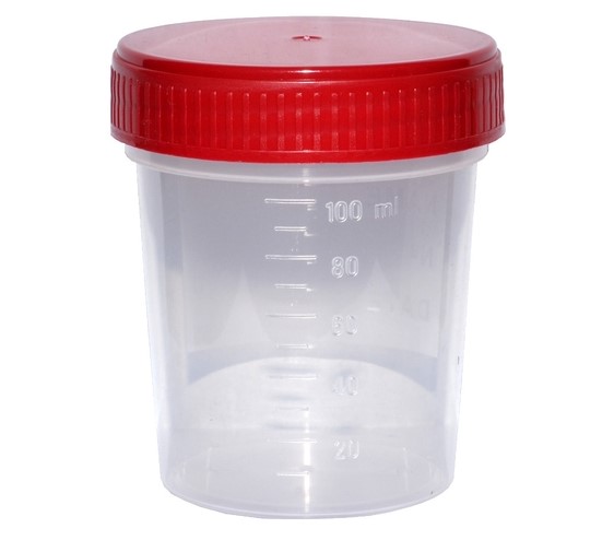 Contenitore per urine 120ml non sterile 1pc
